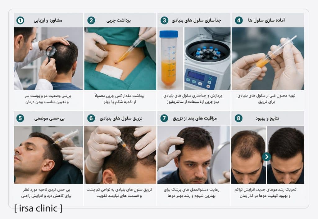 آیا کاشت مو با سلولهای بنیادی واقعاً امکانپذیر است؟