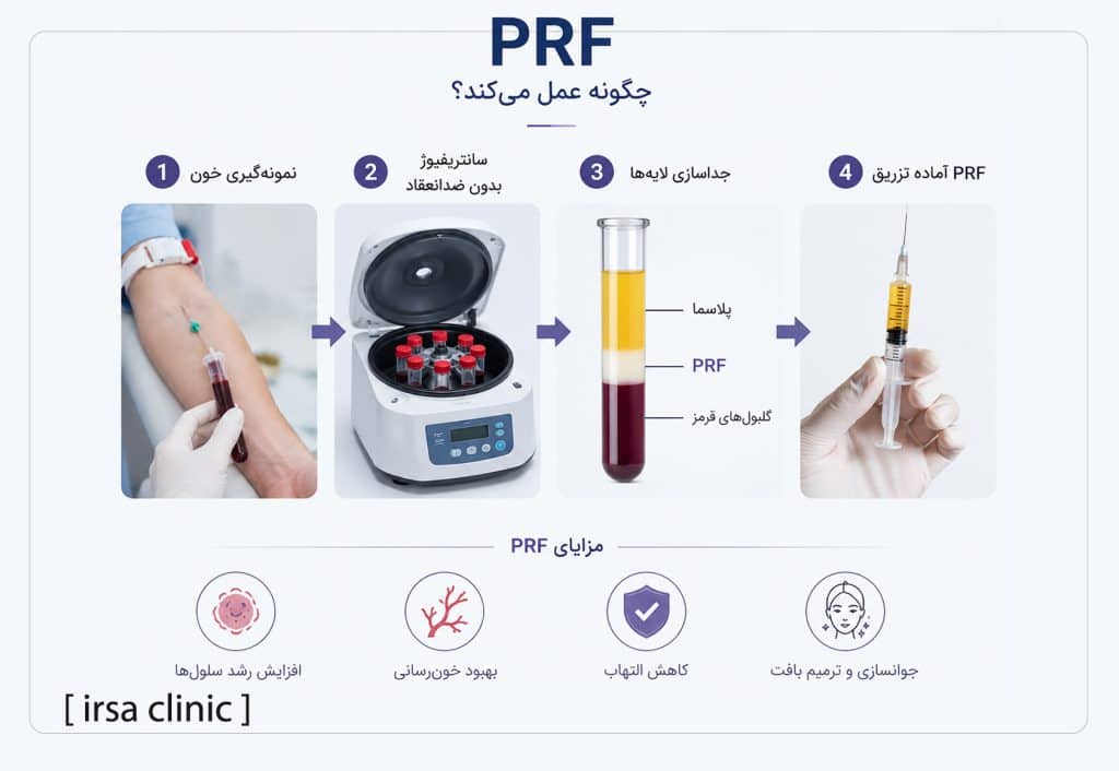 PRF چگونه عمل میکند؟