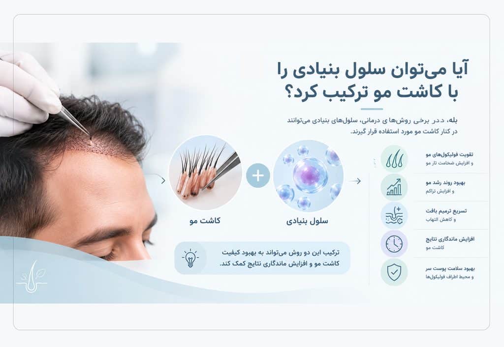 آیا میتوان سلول بنیادی را با کاشت مو ترکیب کرد؟