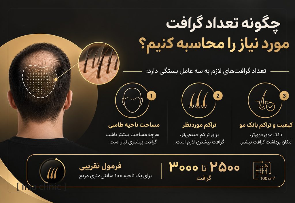 چگونه تعداد گرافت مورد نیاز را محاسبه کنیم؟