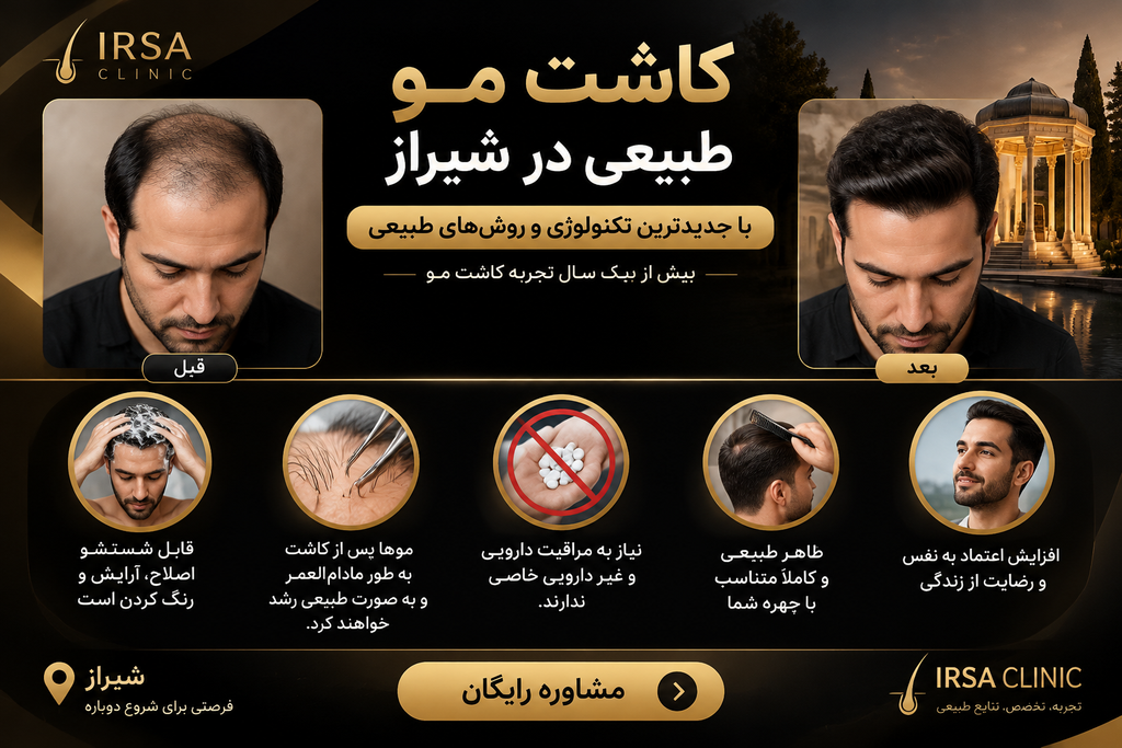 مزایای کاشت مو چیست؟