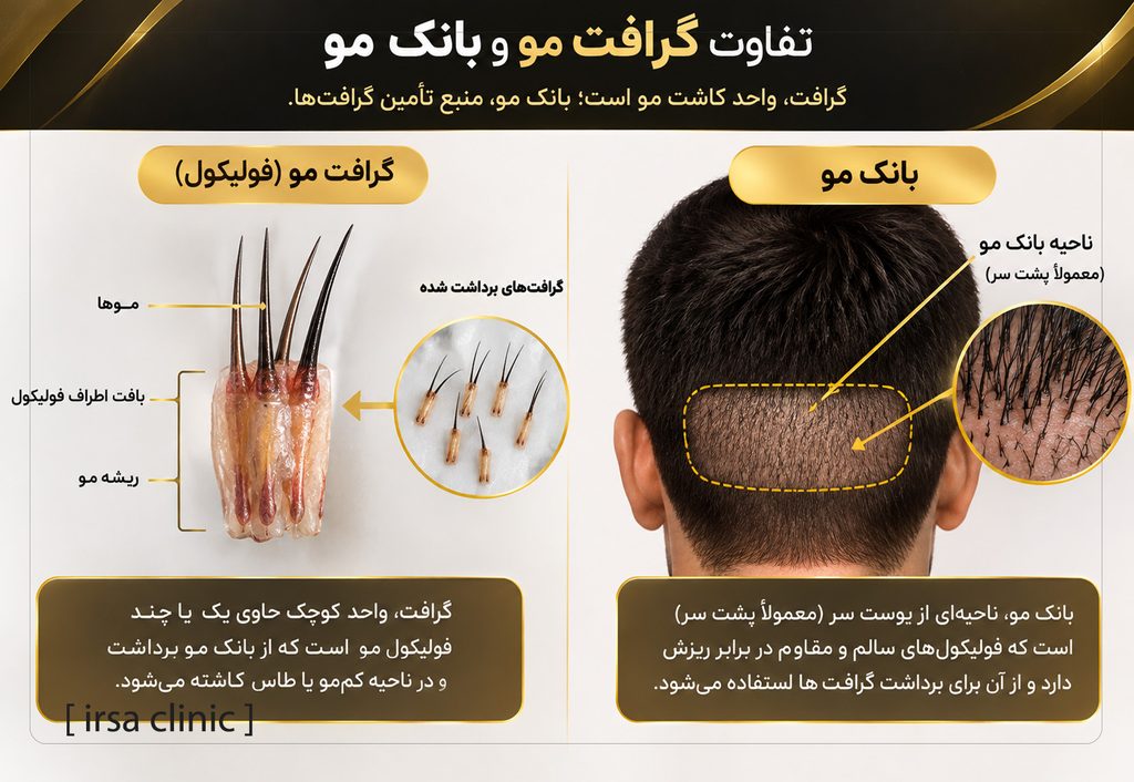 تفاوت گرافت مو و بانک مو در فرایند کاشت مو